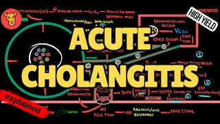 ASCENDING CHOLANGITIS Pathogenesis Diagnostic criteria Charcot triad Reynolds Pentad