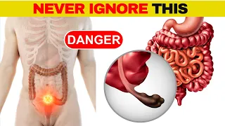 TOP 8 Critical COLON CANCER Symptoms You Should NEVER Ignore | Strong & Healthy