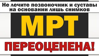 МРТ: Диагноз и лечение на основании снимков - это плохо!