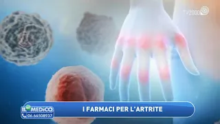 Freddo e artrite: cosa fare? I farmaci e le cure per l'artrite