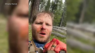 Veteran recovering from brain tumor on honeymoon attacked by grizzly bear