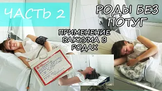 МОЯ ИСТОРИЯ РОДОВ ЧАСТЬ 2 ПРИМЕНЕНИЕ ВАКУУМНОЙ СИСТЕМЫ В РОДАХ