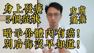 老人身上「發癢」，出現5個症狀，暗示體內有癌！你的健康壽命受到影響了！如果你一個都不占，活到100歲沒問題！