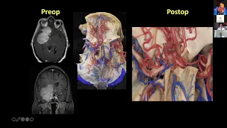 Surgical Anatomy of the skull base Anterolateral Approaches the Lab and the OR, the Inseparables