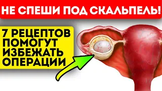 Хирургу лишь бы резать?! От этих рецептов киста яичника рассосётся сама