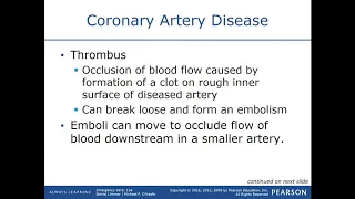 Cardiac Emergencies Lecture 2 / EMT MADE EASY