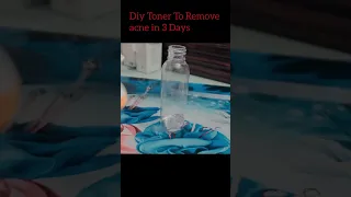 Diy Toner To Remove Acne In 3 Days ||Glow and Glam ||#shortsvideo #short #diytoner #acneremoval acne
