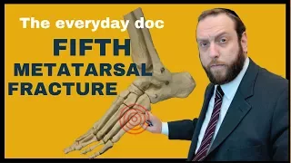 Fifth metatarsal Fracture