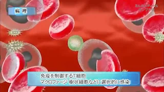 エイズ（後天性免疫不全症候群）／2分で分かる医療動画辞典　ミルメディカル