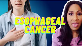 What is Esophageal Cancer? What Are the Symptoms? A Doctor Explains