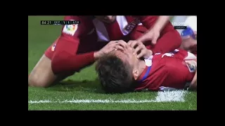 Fernando Torres Horrible Injury - Deportivo La Coruna vs Atletico Madrid 1-1 - La Liga 02/03/2017 HD