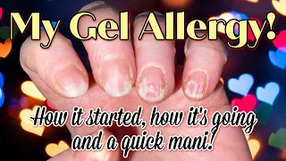My Gel Nail Polish Allergy | How It's Going & A Quick Manicure