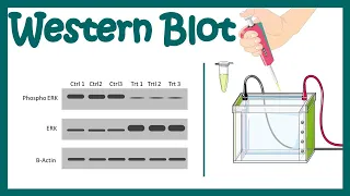 Western blot | Western blotting protocol | Application of Western Blot | Limitations of Western blot