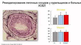 Царева Н.А. Легочная гипертензия при заболеваниях легких