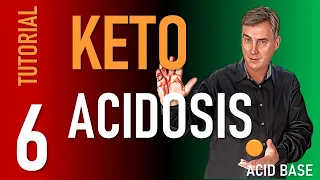 Tutorial 6 Ketoacidosis