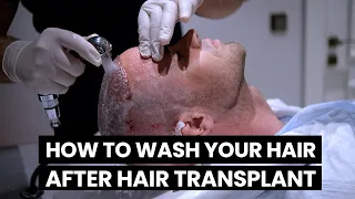 HOW TO WASH YOUR HAIR AFTER HAIR TRANSPLANT? | DR. FIRDAVS AHMEDOV | SMILE HAIR CLINIC