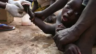 Guinea Worm