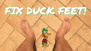 How to Fix Duck Feet! (Out-Toeing)
