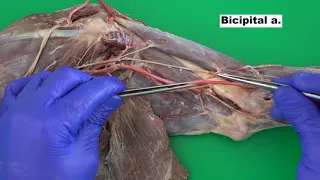 Blood Supply to the Forelimb of the Dog