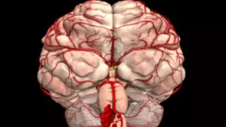 Brainstem herniation - Neuroanatomy