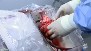 Device that keeps a donor heart beating