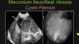 sonography gastrointestinal Emergencies