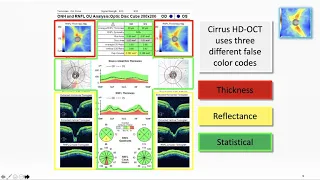 Optimizing OCT Usage In Glaucoma Management