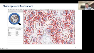 MorphLink: Bridging Cellular Morphological Behaviors and Molecular Dynamics in Spatial Omics