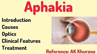 Aphakia |AK khurana 6th edition |Opto-cruisers #optometry #optometrists #aphakia #eye #youtube