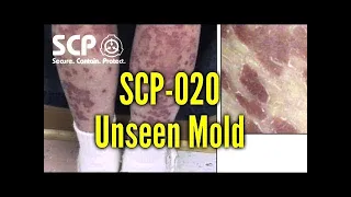 TSN - SCP-020 ( "Unseen" MOLD )