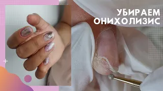 Вернулась с ОНИХОЛИЗИСОМ 👌 ПРОТЕЗИРОВАНИЕ ногтя. Маникюр из Инстаграм «Натуральные текстуры»