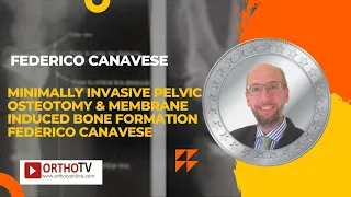 Posi Web28  Minimally Invasive Pelvic Osteotomy  &Membrane Induced bone formation Federico Canavese