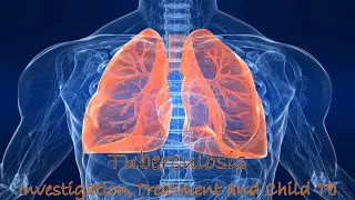Tuberculosis- Investigation, Treatment and Tb in Children