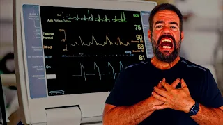 20 AFIB Triggers In Only 7.5 Minutes? Wow!