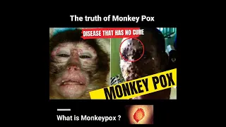 Monkeypox : what is monkey pox virus ??