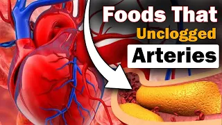Stop Heart Attacks: 10 Foods That Unclog Arteries Now!