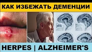 Герпес связали с болезнью Альцгеймера | Alzheimer's and Herpes