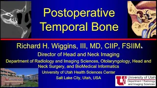 Post operative Temporal Bone