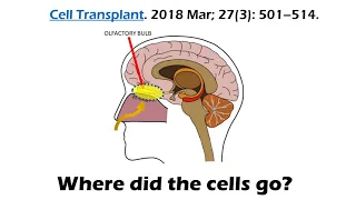 Is Intranasal Delivery of Stem Cells to Treat brain Disease a Real Thing?