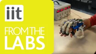 Rehab - Direct-driven Optimized Hand Exoskeleton