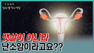 복부 팽만, 복통, 변비, 위장장애 등 난소암의 증상과 특징🧾갱년기에 찐 뱃살인 줄 알았는데, 증상을 느꼈을땐 이미 난소암 3,4기라는데... (KBS 20230802 방송)