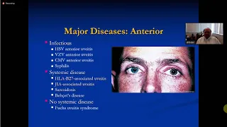 Principles in the Diagnosis of Uveitis. Dr Foster