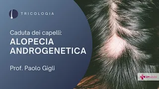 Alopecia androgenetica - Prof. Paolo Gigli - UPsalute Channel