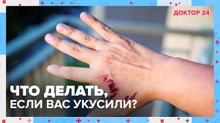 ПРАВДА и МИФЫ о БЕШЕНСТВЕ | Доктор 24