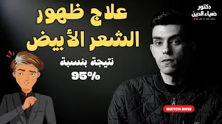 علاج شيب الشعر المبكر و الشعر الأبيض اذا كنت تحت ال 50 سنه | الأسباب الصادمة و الحل البسيط