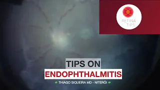 Tips on Endophthalmitis