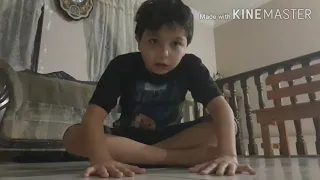 Niño se disloca el brazo video completo (GRACIOSO)😂😂😂