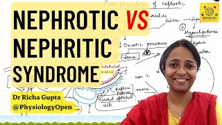 Nephrotic vs nephritic syndrome pathology | MBBS | Glomerular diseases patho
