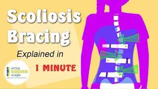 Scoliosis Brace   |   Explained Under 1 Minute