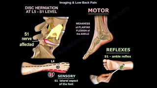 Imaging & Low Back Pain - Everything You Need To Know - Dr. Nabil Ebraheim